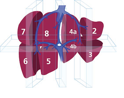 Dr Sandroussi - liver resection